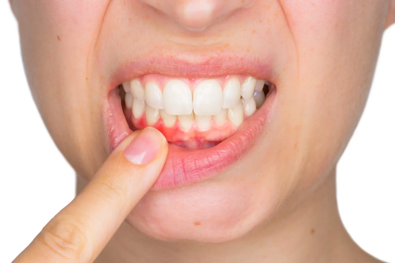 Maintaining Healthy Gums in Brooklyn, NY